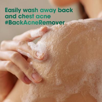 AHA BHA PHA 30 Days Miracle Acne Clear Body Cleanser